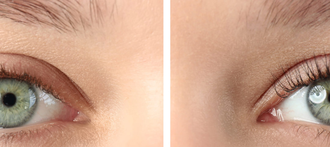 Ein kritischer „Blick“ auf Wimpernseren